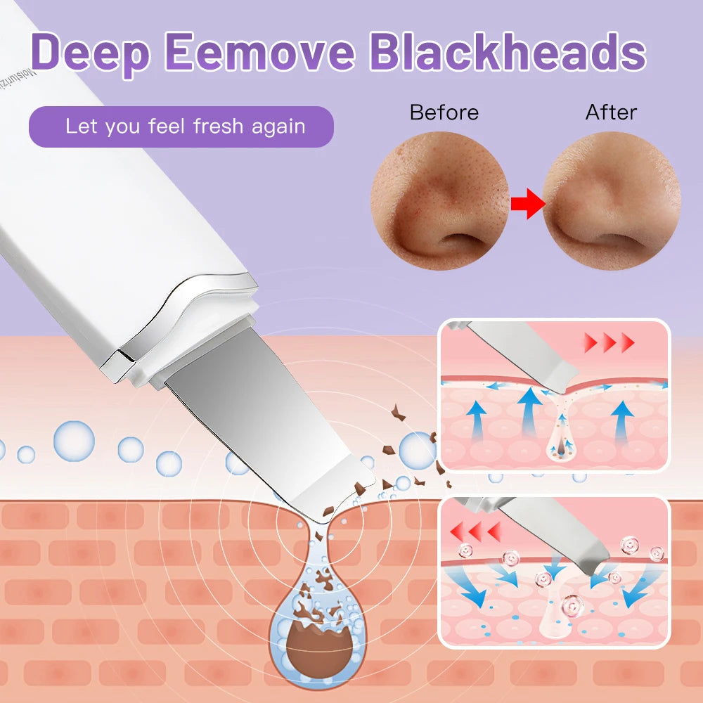 Ultrasonic Skin Scrubber & Blackhead Remover – Deep Pore Facial Cleaner for Glowing Skin