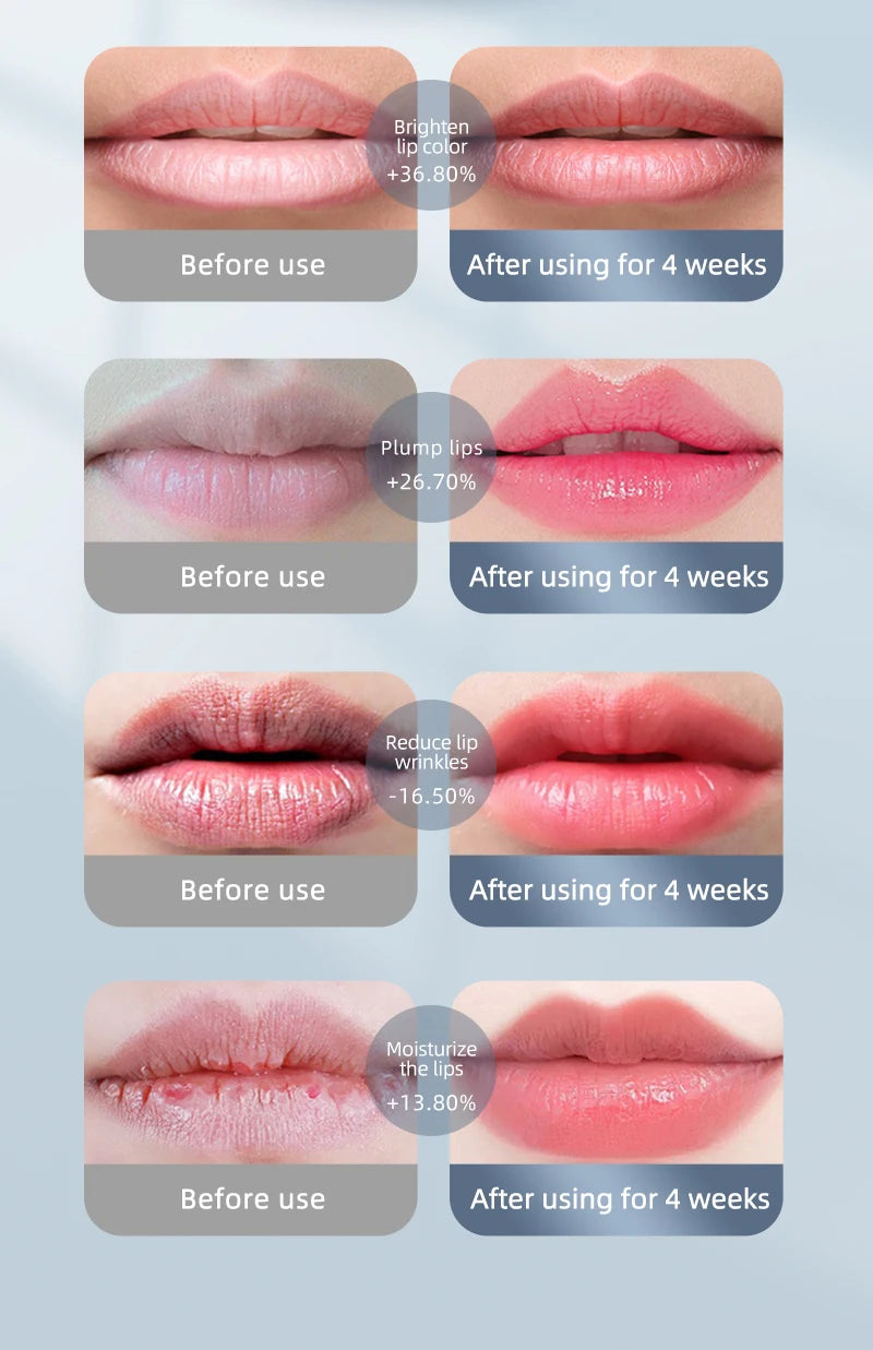 2-in-1 LED Phototherapy Lip & Teeth Care Device – Dual Repair for Plump Lips & Whiter Smile | Anti-Aging Light Therapy Massage