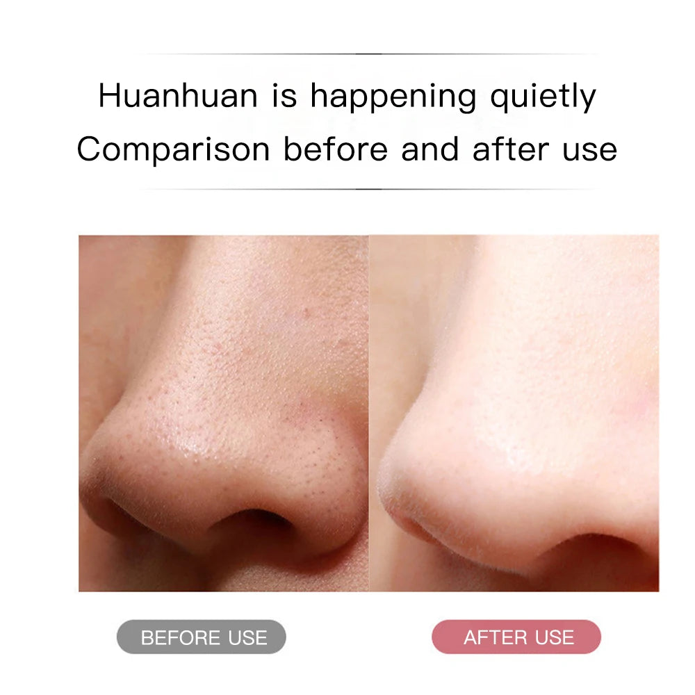 Ultrasonic Skin Scrubber & Blackhead Remover – Deep Pore Facial Cleaner for Glowing Skin