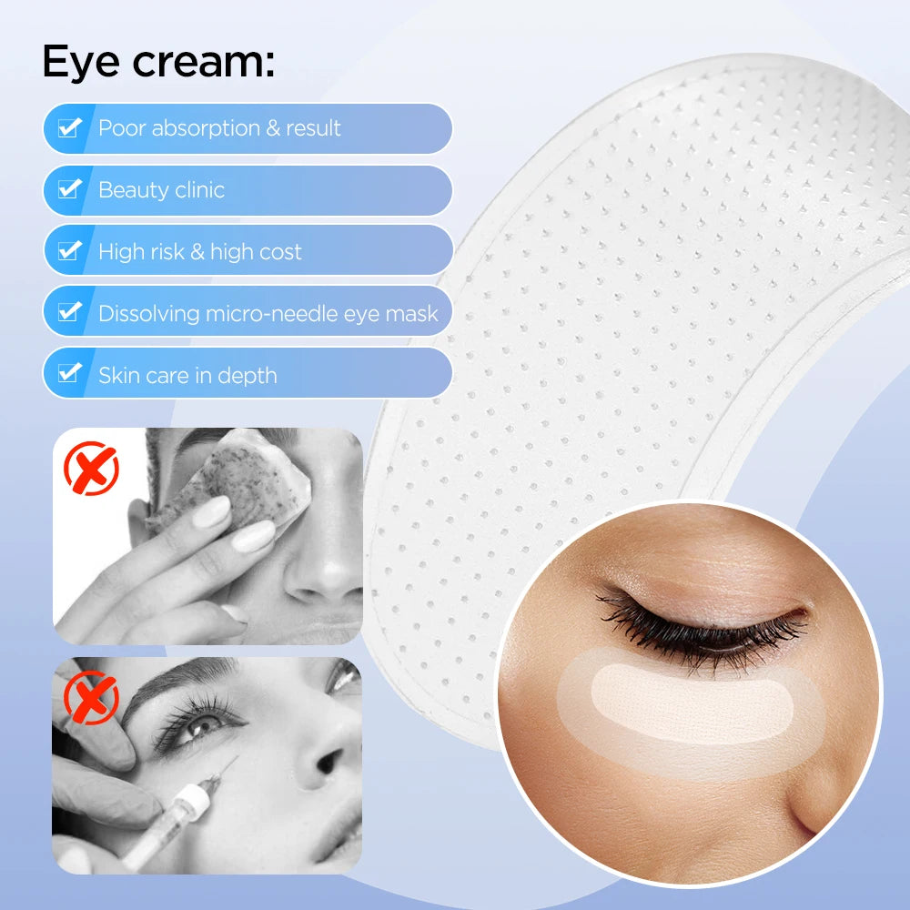 Hyaluronic Acid Micro-Needle Eye Patches – Reduce Dark Circles, Fine Lines & Eye Bags Fast