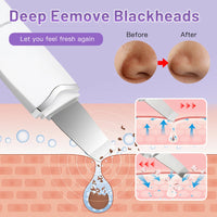 Ultrasonic Skin Scrubber & Blackhead Remover – Deep Pore Facial Cleaner for Glowing Skin