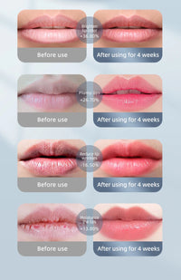 2-in-1 LED Phototherapy Lip & Teeth Care Device – Dual Repair for Plump Lips & Whiter Smile | Anti-Aging Light Therapy Massage