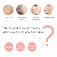 Ultrasonic Skin Scrubber & Blackhead Remover – Deep Pore Facial Cleaner for Glowing Skin